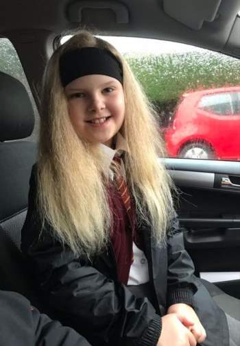 Mắc hội chứng hiếm gặp, bé gái người Anh sở hữu mái tóc y hệt thiên tài Vật lý Einstein - Ảnh 5