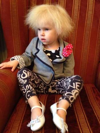 Mắc hội chứng hiếm gặp, bé gái người Anh sở hữu mái tóc y hệt thiên tài Vật lý Einstein - Ảnh 2