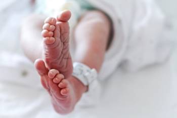 Em bé sinh ra với 2 D**ng v*t và 2 niệu đạo riêng biệt, kết quả của sự phân tách không hoàn toàn của các thai nhi song sinh - Ảnh 1.