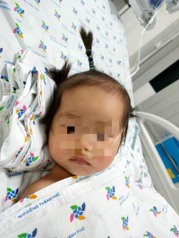 Bé gái 15 tháng tuổi bệnh tay chân miệng biến chứng nặng - Ảnh 1.