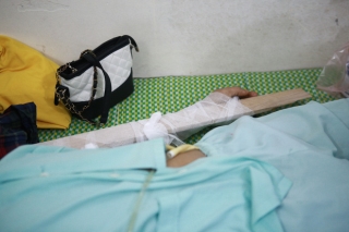 Tình hình sức khỏe của các nạn nhân bị thương trong vụ lốc xoáy ở Vĩnh Phúc: 2 bệnh nhân nặng bị gãy xương đùi, có biểu hiện sốc chấn thương - Ảnh 4.