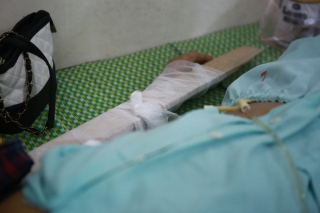 Tình hình sức khỏe của các nạn nhân bị thương trong vụ lốc xoáy ở Vĩnh Phúc: 2 bệnh nhân nặng bị gãy xương đùi, có biểu hiện sốc chấn thương - Ảnh 6.