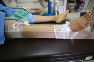 Tình hình sức khỏe của các nạn nhân bị thương trong vụ lốc xoáy ở Vĩnh Phúc: 2 bệnh nhân nặng bị gãy xương đùi, có biểu hiện sốc chấn thương - Ảnh 7.