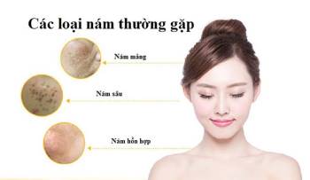 Review 10 kem trị nám, tàn nhang đang được chị em lựa chọn hiện nay - ảnh 1