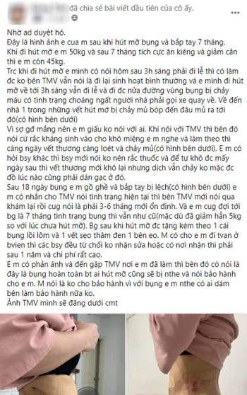 Hút mỡ bụng: Sau phẫu thuật bao lâu có thể đi lại, sinh hoạt bình thường? - Ảnh 1.