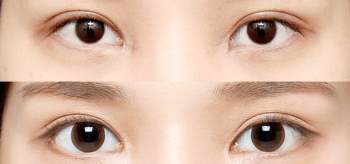 Mở góc mắt: Người sở hữu mắt một mí, mắt nhỏ, mắt ngắn hãy 