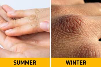 7 vấn đề sức khỏe có thể xảy ra với cơ thể vào mùa đông - 7
