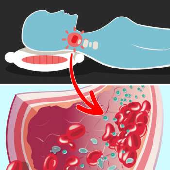 Điều gì sẽ xảy ra với làn da của bạn nếu bạn ngủ mà không có gối? - Ảnh 10.