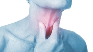  Những dấu hiệu đặc trưng của ung thư vòm họng nhưng rất dễ bị nhầm lẫn với bệnh ngạt mũi thông thường - Ảnh 1