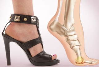 Những kiểu giày dép gây hại cho chân chị em cần loại bỏ hoặc hạn chế sử dụng - Ảnh 3