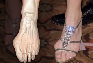 Những kiểu giày dép gây hại cho chân chị em cần loại bỏ hoặc hạn chế sử dụng - Ảnh 6