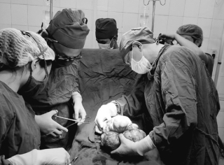  Phẫu thuật lấy thành công khối u 3,5kg cho nữ bệnh nhân 