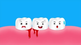 Mỗi lần đánh răng là lợi lại chảy máu không ngừng, ngã ngửa khi biết nguyên nhân - Ảnh 1.