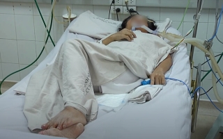 TP.HCM: Thêm 1 bệnh nhân phải thở máy, nguy kịch do ăn Pate Minh Chay dù sản phẩm đã có vị chua - Ảnh 1.