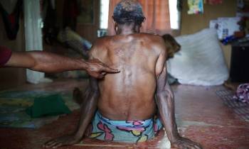 Số phận bi thảm của người bị kết tội phù thủy ở Papua New Guinea - Ảnh 2.