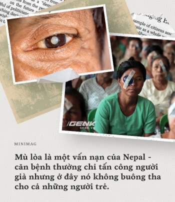 Vị bác sĩ huyền thoại, người đem ánh sáng trở lại hơn 130.000 đôi mắt nghèo - Ảnh 2.