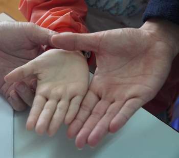 Hành trình chữa bệnh tan máu bẩm sinh cho con của người mẹ Lâm Đồng - Ảnh 2.