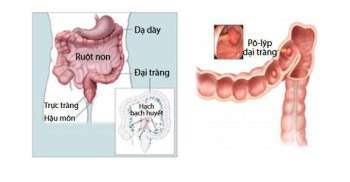 7 dấu hiệu nhận biết ung thư có thể tự kiểm tra - Ảnh 2.