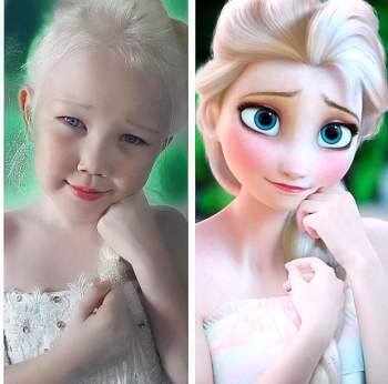 9 em bé nổi tiếng khắp thế giới vì quá đỗi đặc biệt: Từ người sói, cô bé tóc hai màu đến công chúa tuyết đẹp như bước ra từ cổ tích - Ảnh 3.