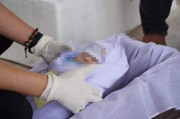 Sau vụ thu gom 1.300 xác thai nhi để mai táng, Bộ Y tế yêu cầu tăng cường kiểm tra, giám sát hoạt động cung cấp dịch vụ Ph* thai - Ảnh 1.
