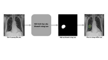 VinBrain và FIT phát hành sách trắng về ứng dụng trí tuệ nhân tạo cho chẩn đoán và tầm soát bệnh lao - Ảnh 2.