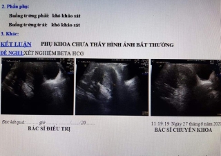 Vụ vác bụng đi đẻ ... nhưng không có thai: Siêu âm không có thai nhưng con vẫn đạp trong bụng? - Ảnh 3.