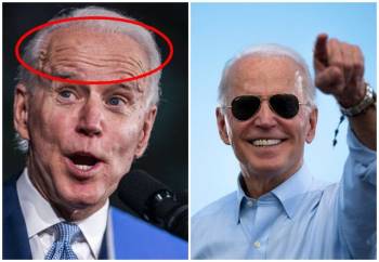 76 tuổi vẫn phong độ lịch lãm, ông Joe Biden để lộ bằng chứng nhiều lần phẫu thuật níu kéo tuổi xuân từ cấy tóc, căng da đến cắt mí - Ảnh 5.