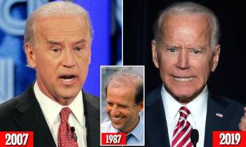 76 tuổi vẫn phong độ lịch lãm, ông Joe Biden để lộ bằng chứng nhiều lần phẫu thuật níu kéo tuổi xuân từ cấy tóc, căng da đến cắt mí - Ảnh 8.