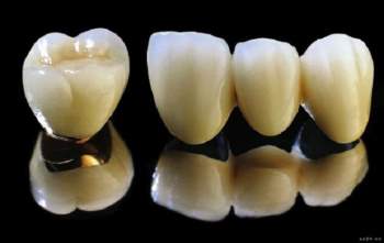 Quy trình chế tác răng sứ thẩm mỹ chuẩn quốc tế tại nha khoa JK Dental - 4