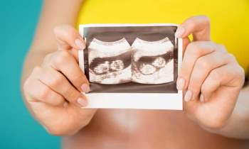 Một phụ nữ mang song thai trong 2 tử cung khác nhau, tỉ lệ 1/50 triệu - Ảnh 1.