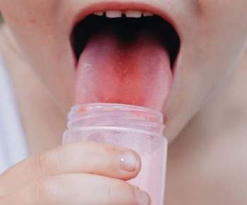 Mẹo chữa bỏng lưỡi khi ăn uống phải món nóng - 7