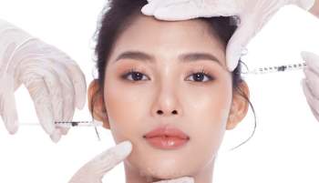 Xóa nhăn đuôi mắt bằng botox: Giải pháp giúp chị em trẻ ra 10 tuổi có thời gian thực hiện dài bằng một giấc ngủ trưa ngắn - Ảnh 1.