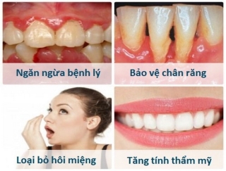 Bác sĩ nha khoa khuyến cáo, nên lấy cao răng theo định kỳ vì điều này có tác dụng tốt đối với sức khỏe răng miệng.