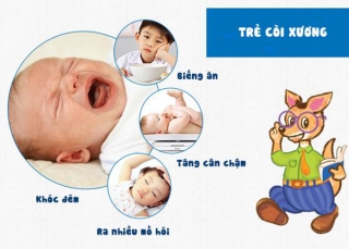 Dấu hiệu nhận biết trẻ bị còi xương ở trẻ.