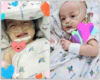 Tin tức đời sống mới nhất ngày 30/7/2020: Hai bé song Nhi đã cai máy thở, sức khoẻ ổn định - Ảnh 1