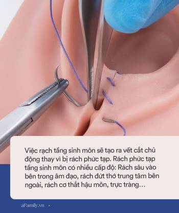 Bác sĩ Sản khoa nói về nỗi sợ hãi của nhiều chị em mang tên 