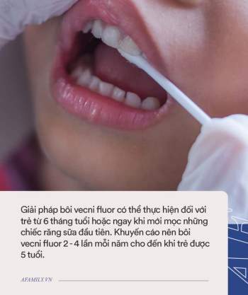 Giải pháp phòng tránh sâu răng cho trẻ đơn giản và an toàn cha mẹ có thể làm cho con ngay từ khi mọc chiếc răng sữa đầu tiên - Ảnh 3.