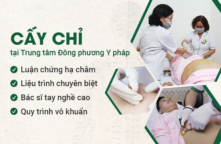 Một số ưu điểm nổi bật về CẤY CHỈ tại Đông Phương Y Pháp