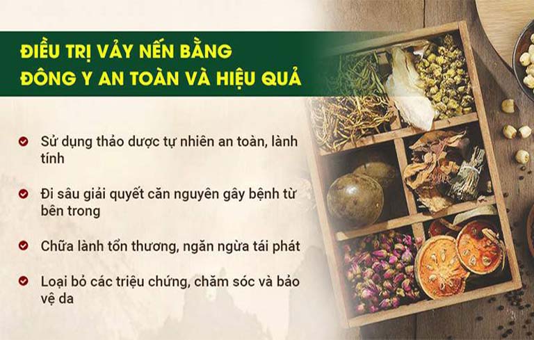 Ưu điểm trong điều trị vảy nến bằng Đông y