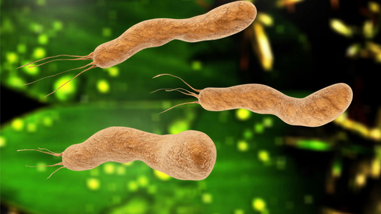 Chữa vi khuẩn HP bằng thuốc Nam có diệt được vi khuẩn?