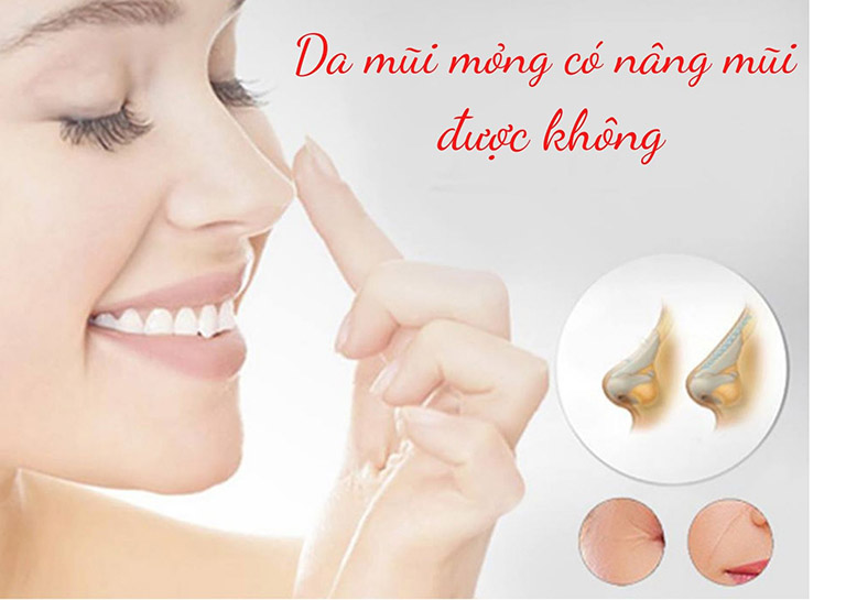 Da mũi mỏng có nâng mũi được không