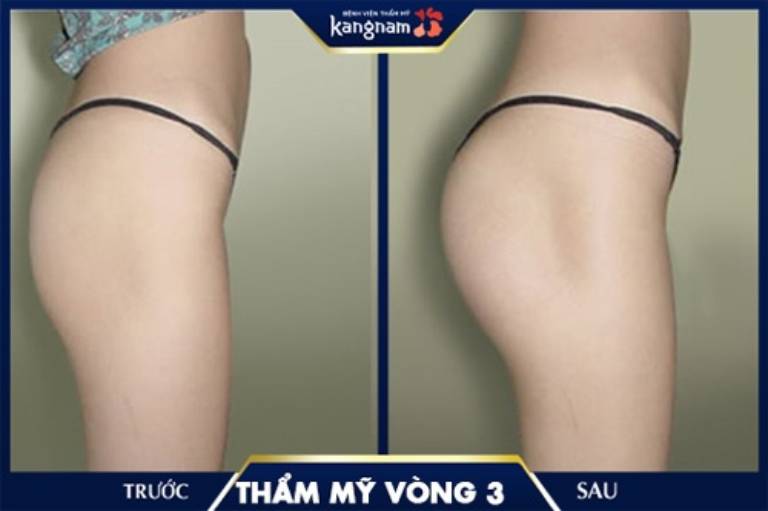 Bệnh viện thẩm mỹ Kangnam