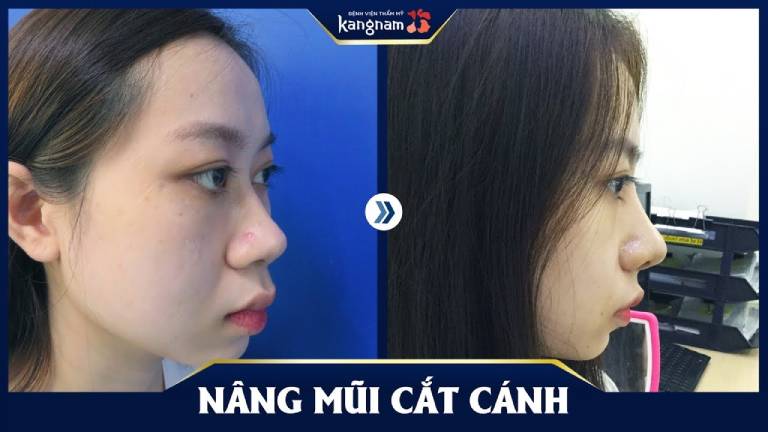 Bệnh viện thẩm mỹ Kangnam