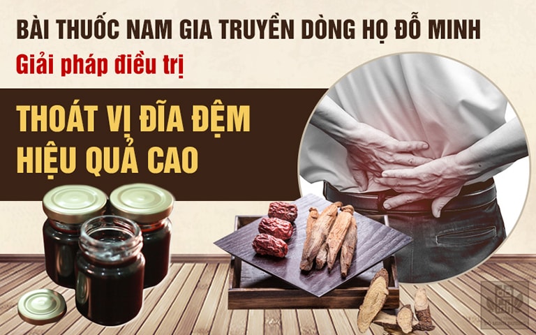 Đỗ Minh thoát vị thang - Giải pháp giúp người bệnh hết đau nhức, dễ dàng vận động