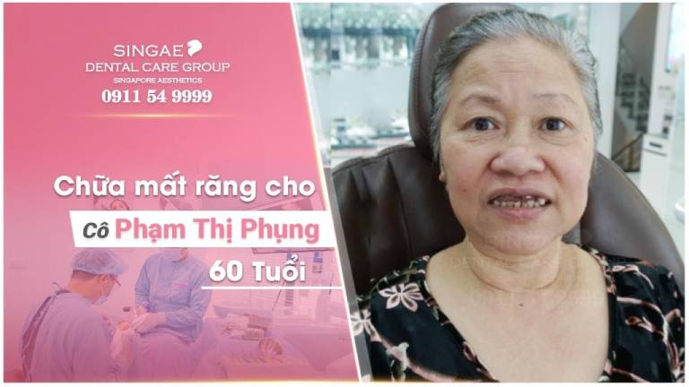 Dịch vụ trồng răng Implant tại Nha khoa Singae