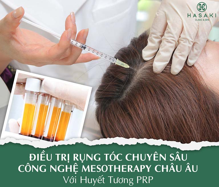 spa trị rụng tóc tphcm