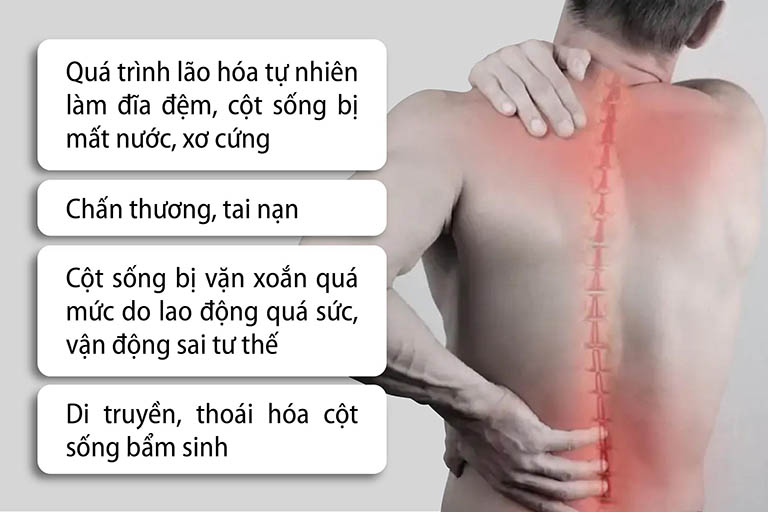 thoát vị đĩa đệm cột sống thắt lưng