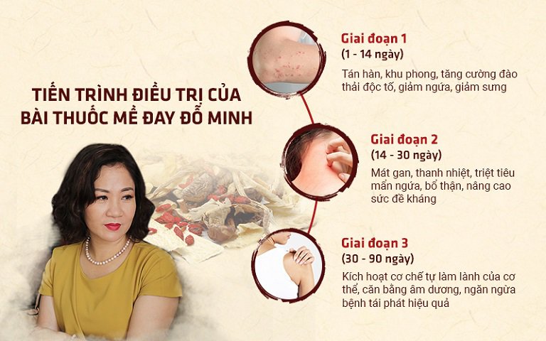 Hiệu quả điều trị dị ứng, mề đay của bài thuốc Mề đay Đỗ Minh