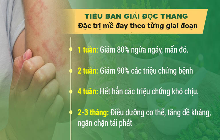 Bài thuốc Tiêu ban Giải độc thang hiệu quả trong điều trị mề đay