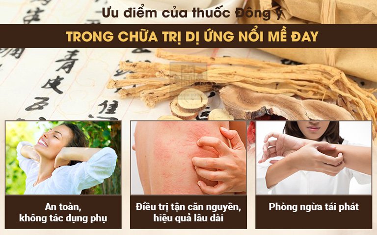 Ưu điểm của thuốc Đông y trong điều trị dị ứng, nổi mề đay mẩn ngứa